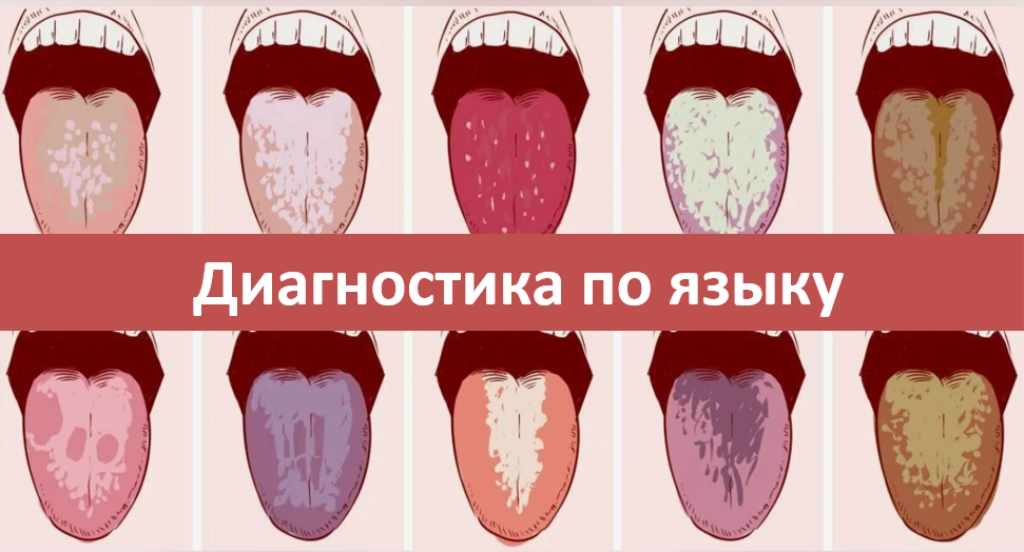 диагностика болезней по языку
